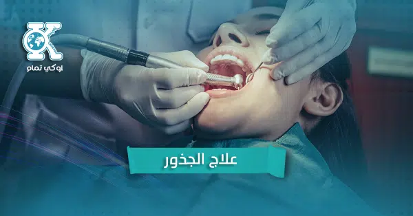 علاج الجذور